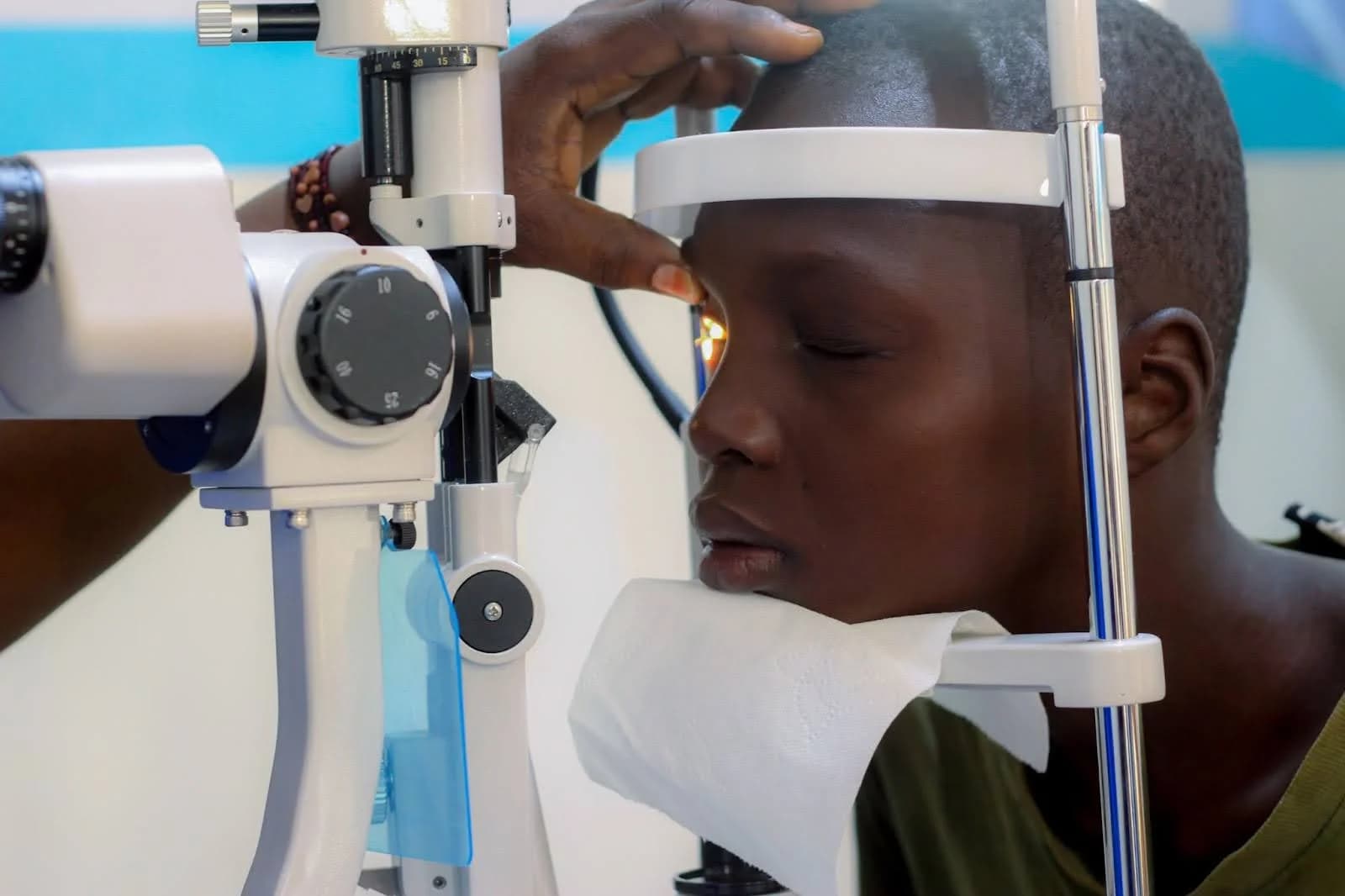 Are Young Adults Facing an Unseen Epidemic of Cataracts?