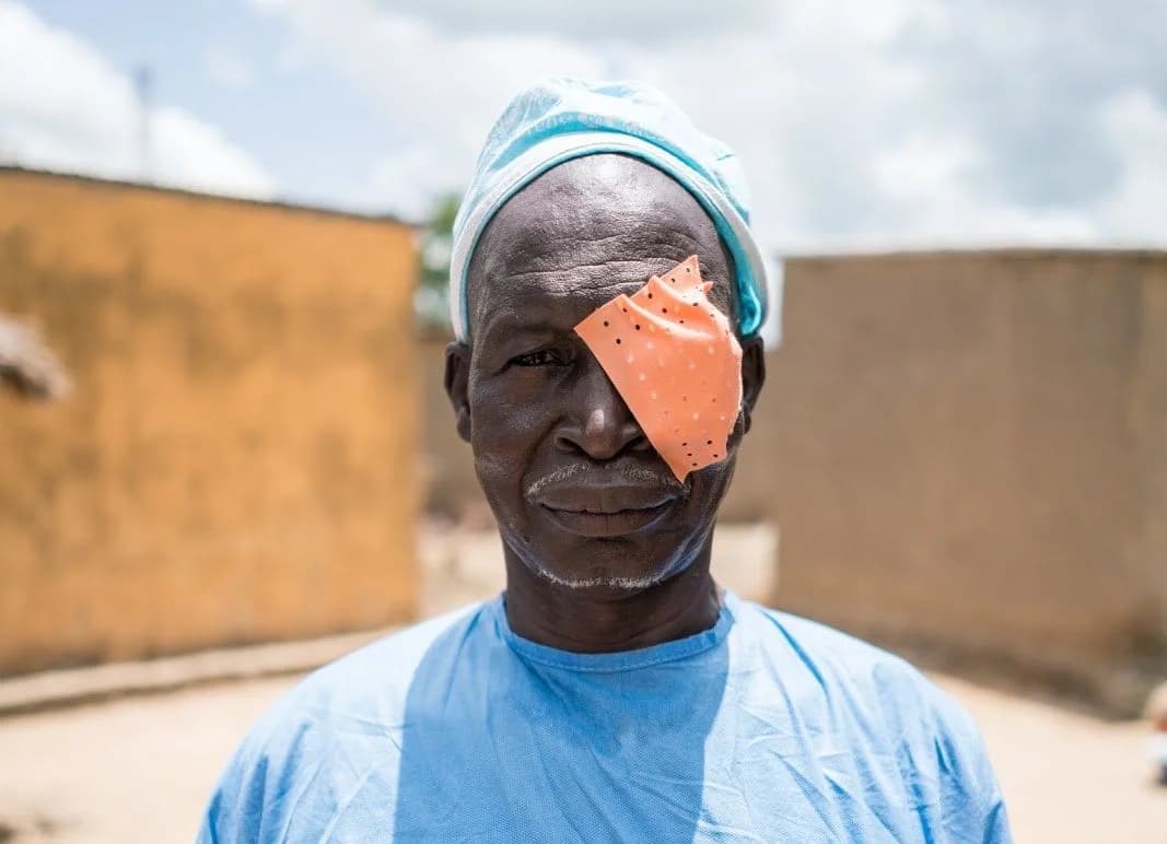 Restoring Vision in Sikasso: Embrace Relief’s Life-Changing Cataract Surgery Program