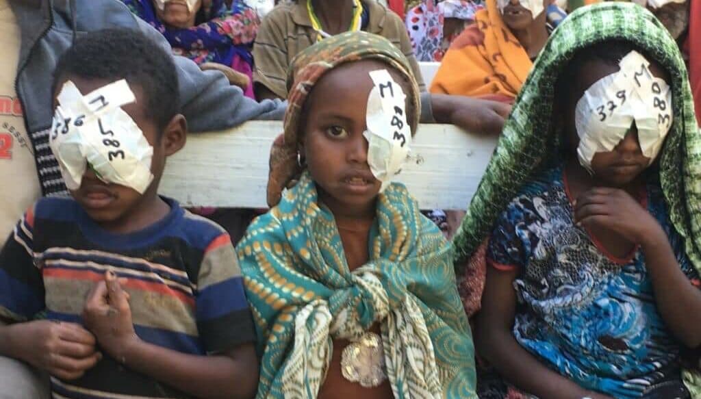 Support A Cataract Surgery
