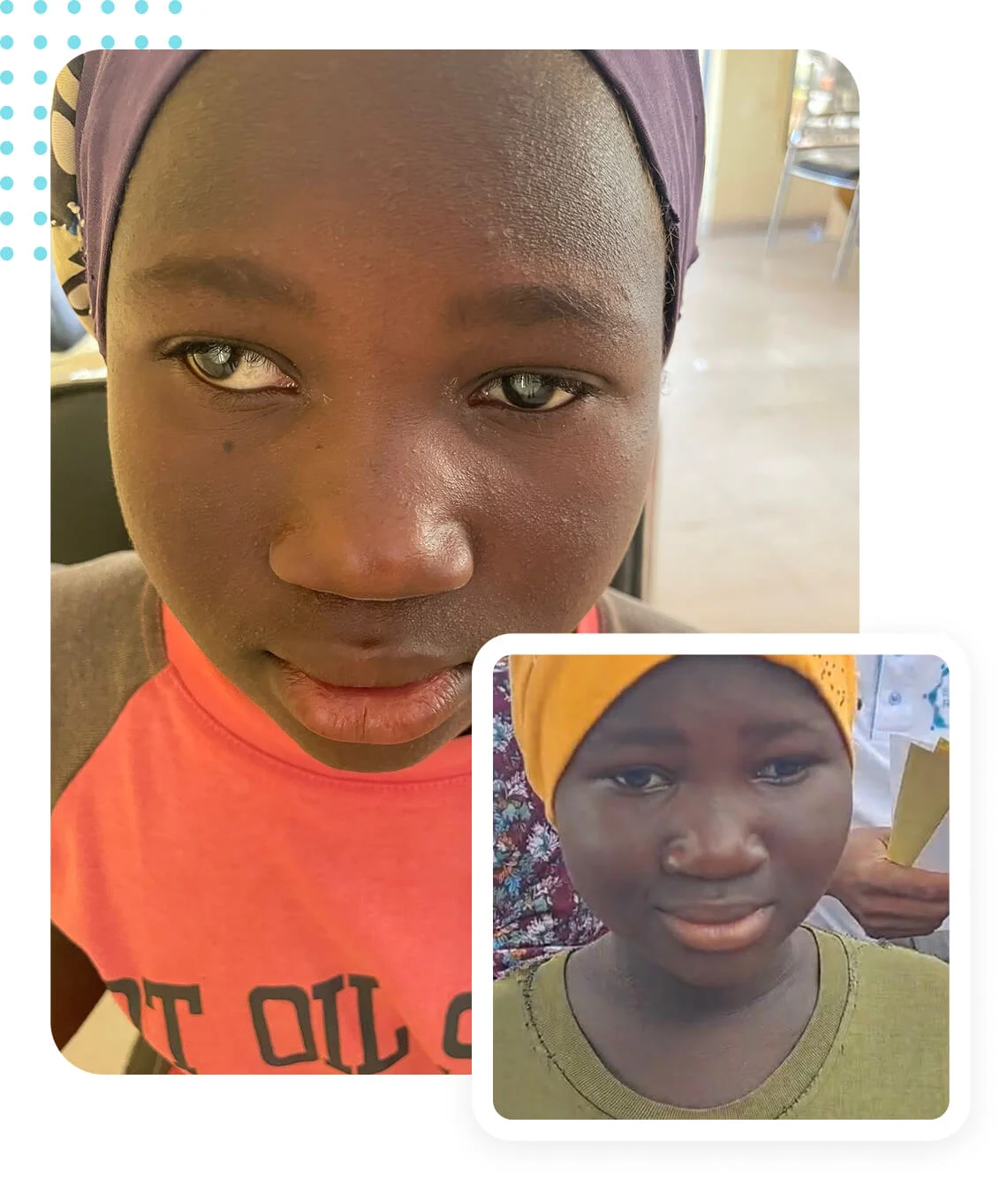 Health Clinic in Mali Cataract Surgery